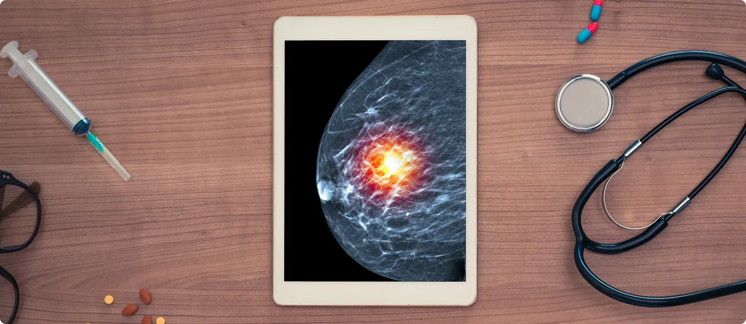 Breast Cancer HER2 Subtype Identification